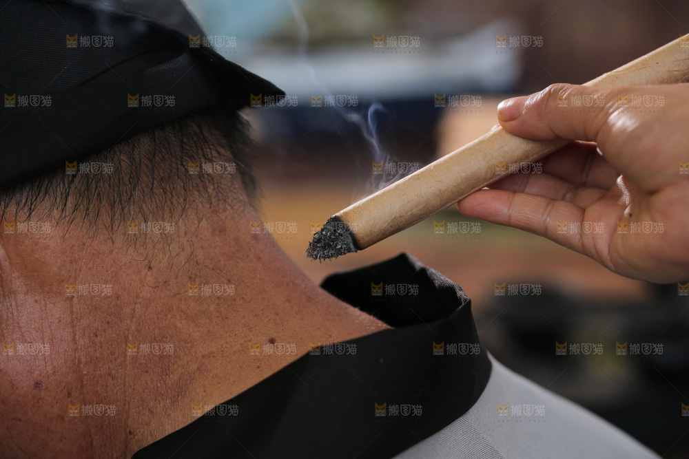 艾灸