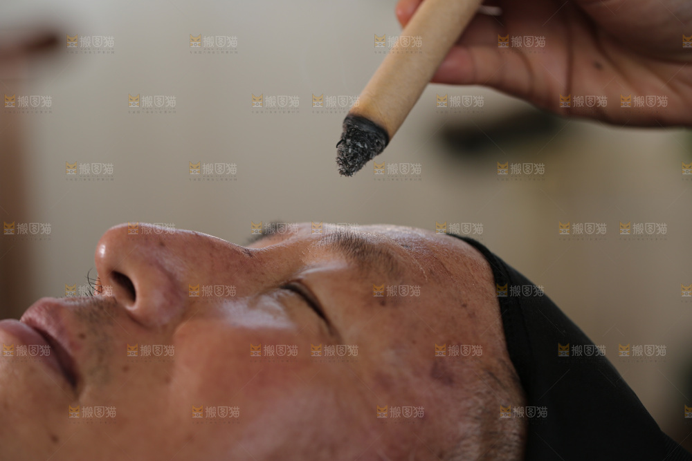 艾灸