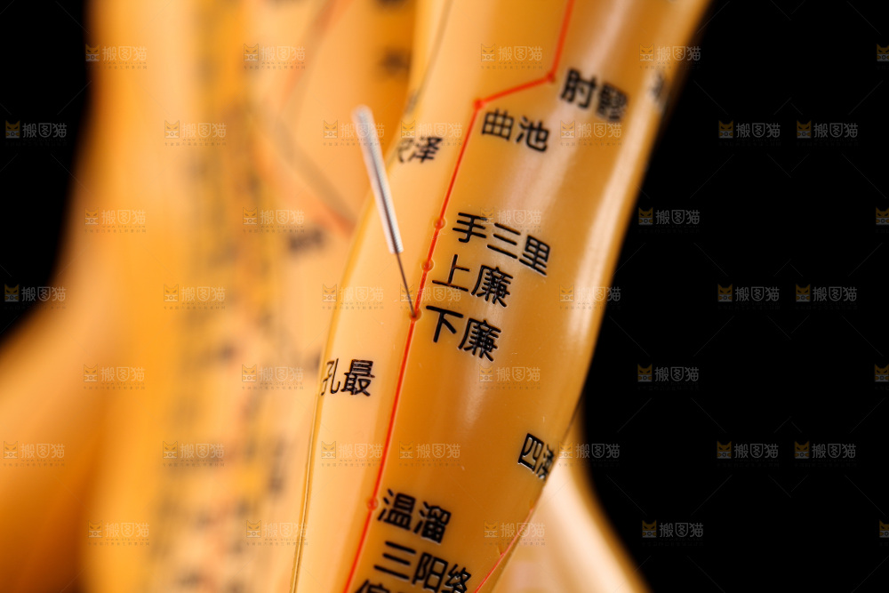 针灸