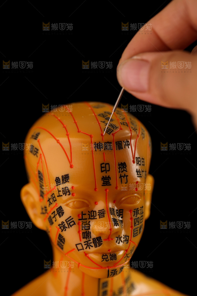 针灸