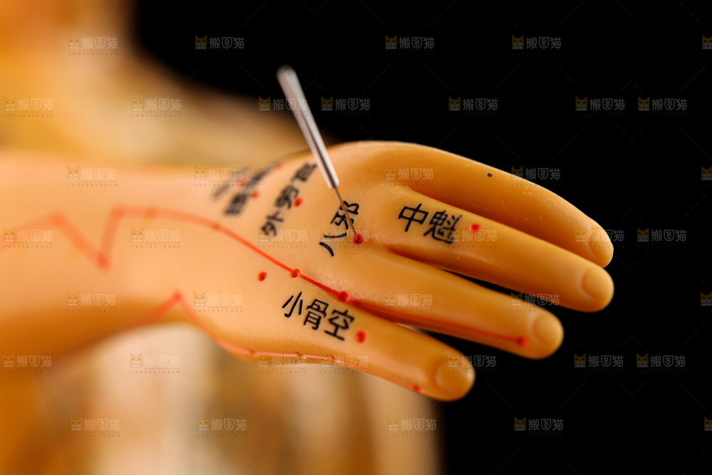 针灸
