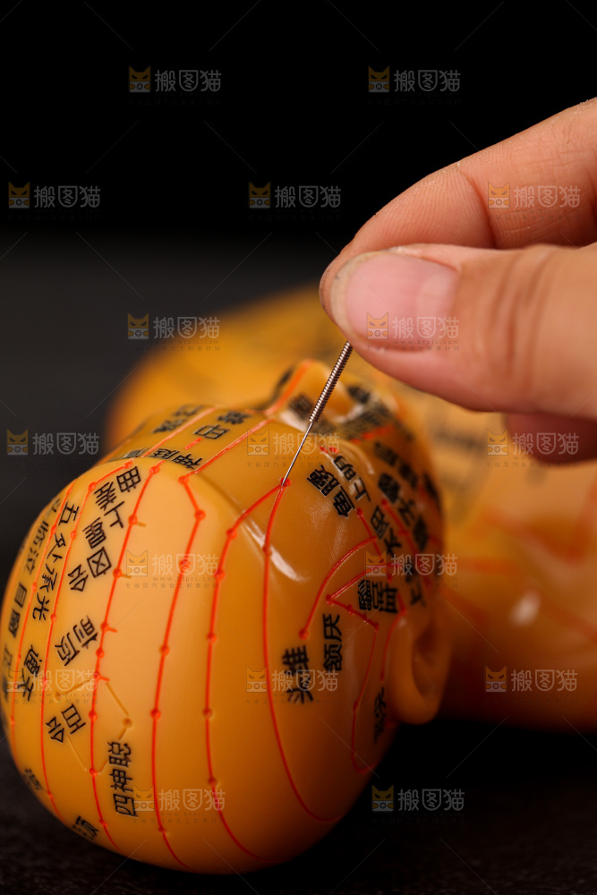 针灸