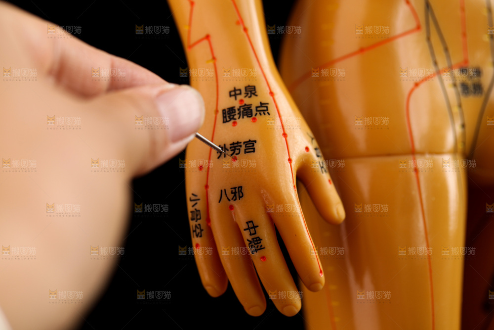 针灸