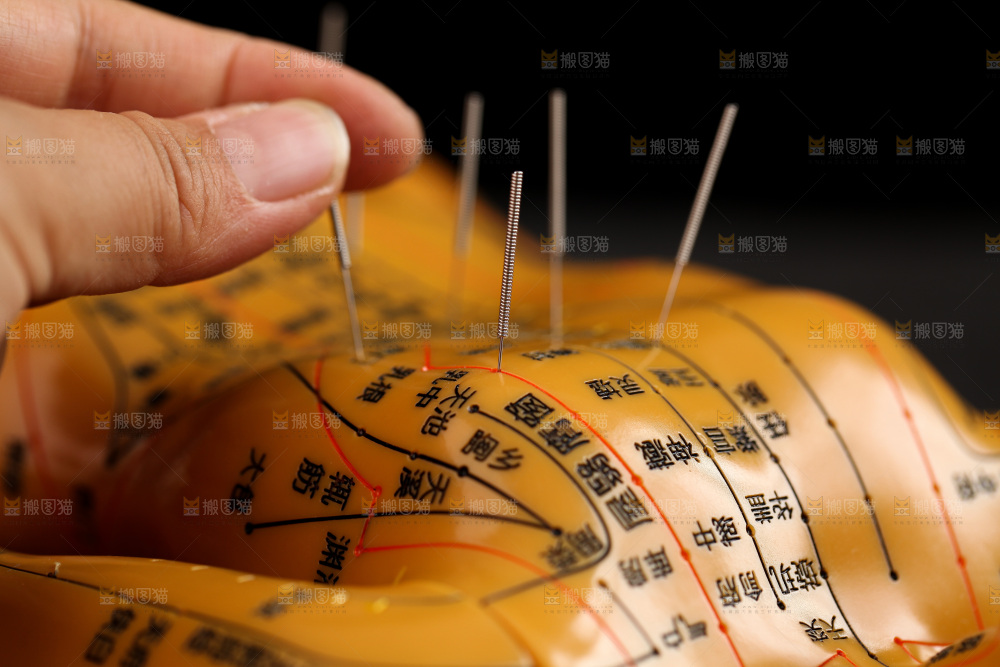 针灸
