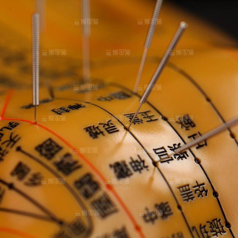 针灸