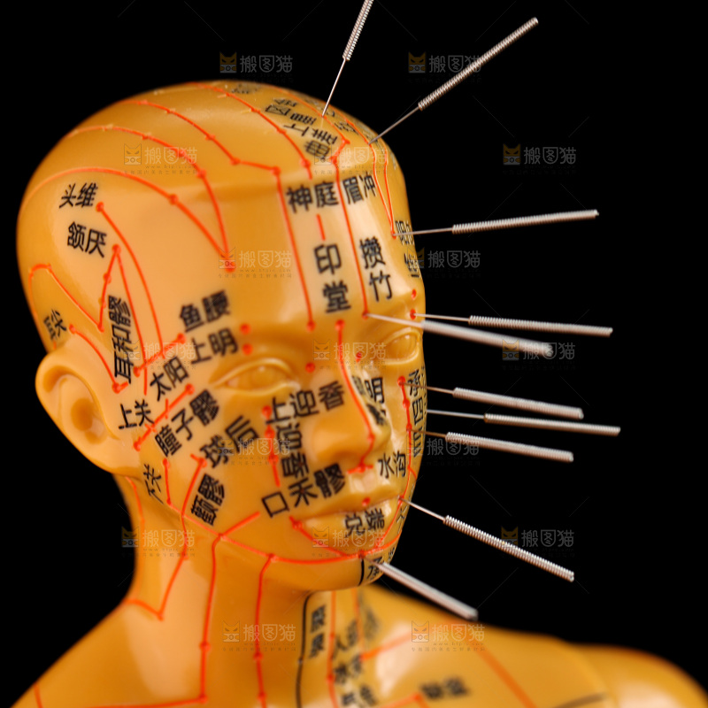 针灸